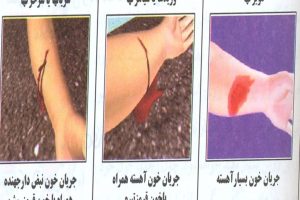 دانلود پاورپوینت خونریزی و زخم کمیاب و عالی ppt