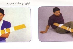 دانلود پاورپوینت شکستگی و آتل بندی کمیاب و عالی