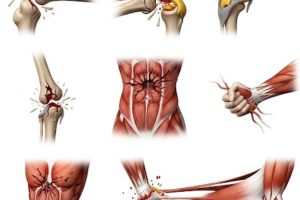 دانلود ppt پاورپوینت تروماهای سیستم اسکلتی عضلانی کمیاب و عالی