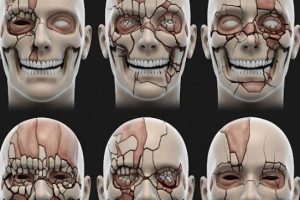 دانلود ppt پاورپوینت شکستگی فک و صورت کمیاب و عالی